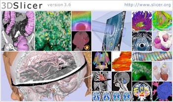 Скриншот 1 программы 3D Slicer