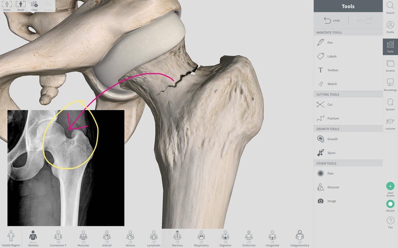 Скриншот 5 программы Complete Anatomy